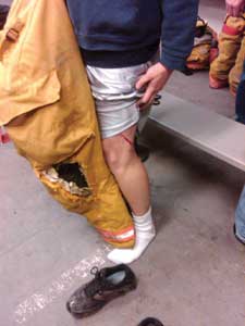 Firefighter Clint Smith shows the consequence of his not being trained to use his weak side. )