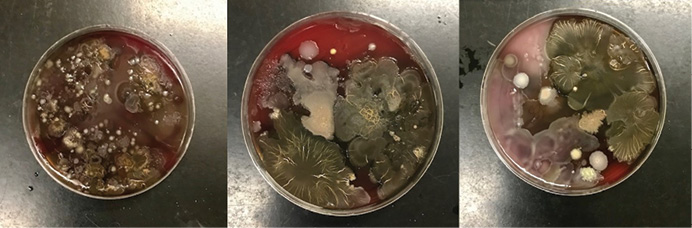 Representative microbial growth on blood agar (BA) plates. BA is a generic agar used to support the growth of a wide variety of microbial species. Using sterile technique, SCBA were swabbed, plated on BA plates, and incubated at 37°C for 24 hours. After 24 hours of growth, multiple species of bacteria and fungi were detected as a result of swab samples taken from the SCBA. 